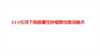 EUS引导下的聚桂醇消融治疗胰腺囊性肿瘤